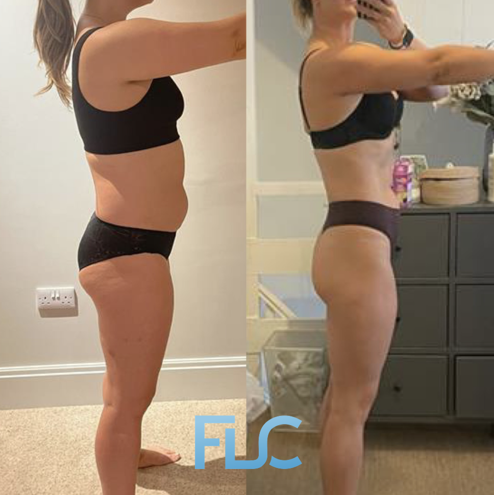 Client before and after transformation