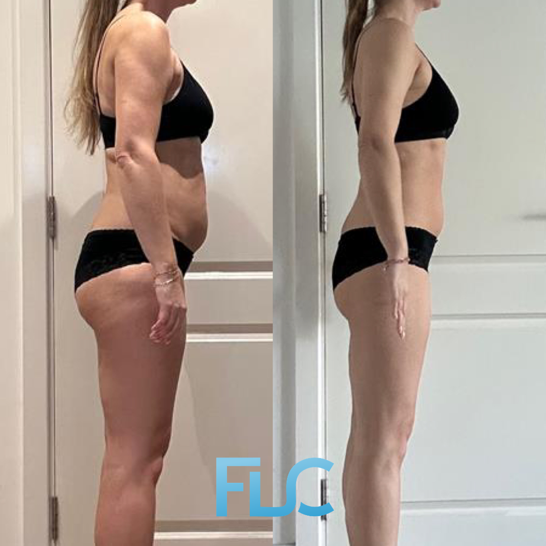 Client before and after transformation
